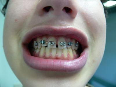 klaar!